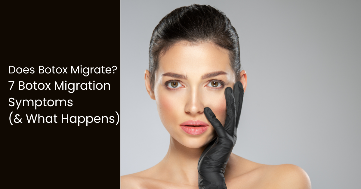Does Botox Migrate